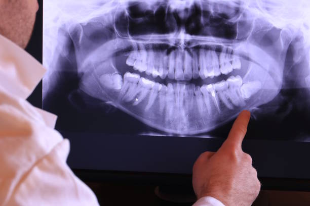 Best Emergency X-Rays and Diagnostics in Lewisville, WA